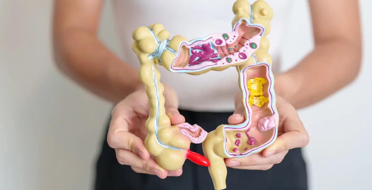 Nutrición para Patologías Digestivas - Clínica Barón Móstoles